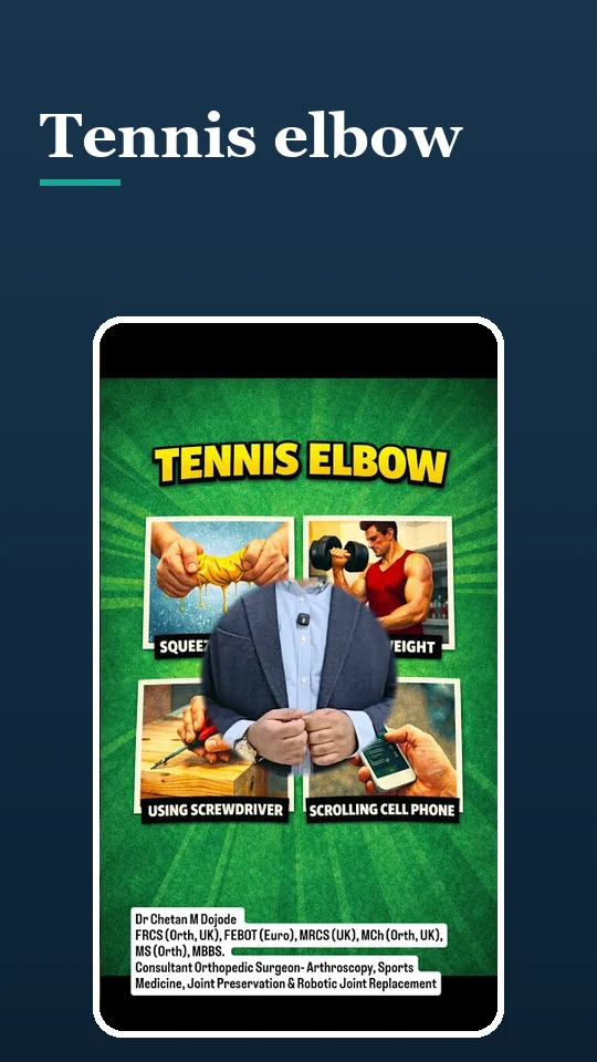 Tennis elbow: it is not only for tennis players
